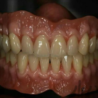 دندانسازی،باضمانت،دندان مصنوعی،دندان سازی|آرایشگری و زیبایی|مشهد, محله پایین خیابان|دیوار