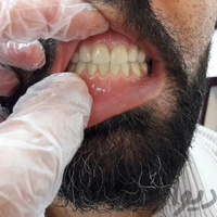 دندانسازی،باضمانت،دندان مصنوعی،دندان سازی|آرایشگری و زیبایی|مشهد, حرم مطهر|دیوار